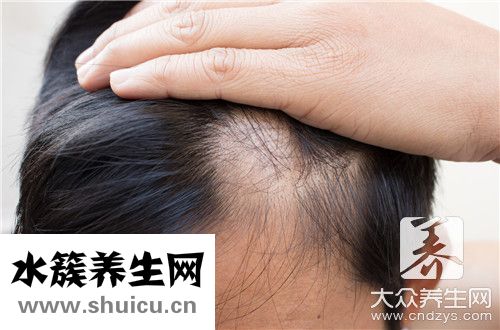 每天脫發多少算正常