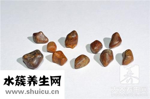 膽結(jié)石術(shù)后飲食