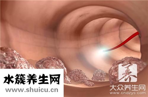 肛周膿腫最好別手術