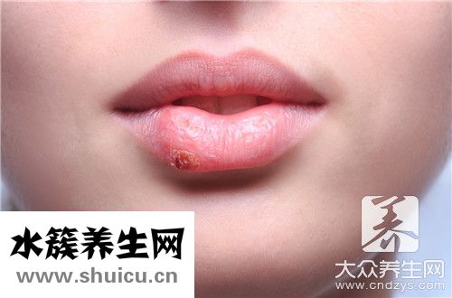 嘴唇干裂快速恢復