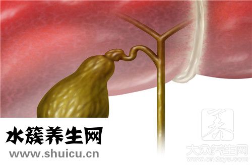 慢性膽囊炎治療