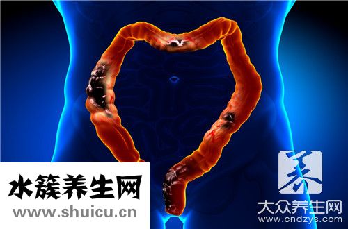 降結(jié)腸管狀腺瘤