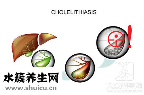 血清膽紅素偏高