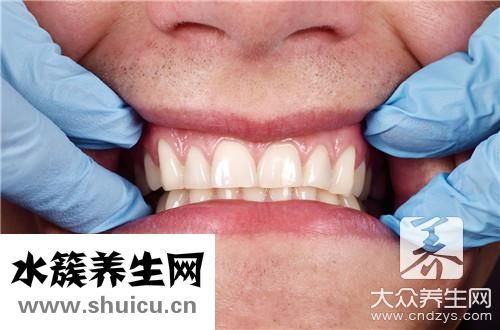 吃東西塞牙縫辦