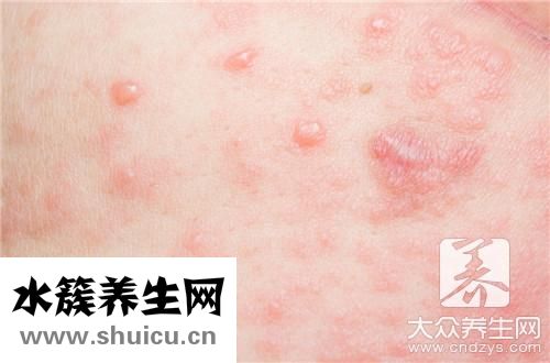 耳后有個硬疙瘩