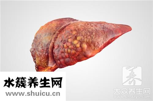 肝臟結(jié)節(jié)