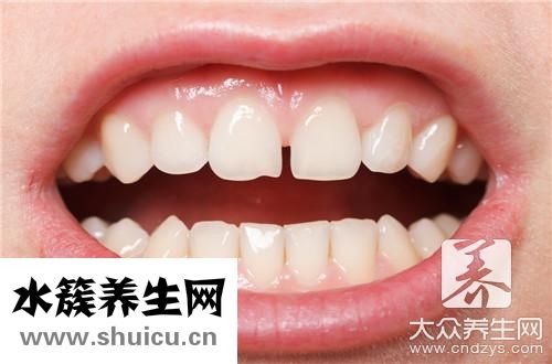 烤瓷牙能用多少年