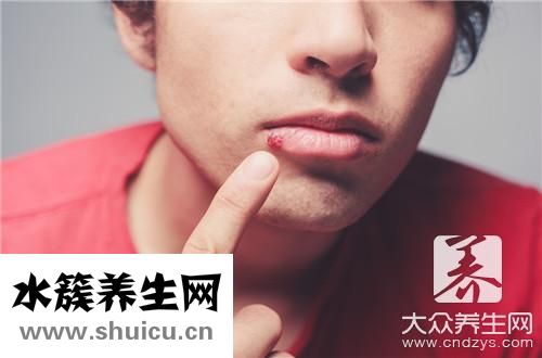 帶狀泡癥水泡幾天能消