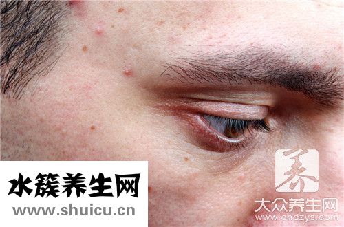 頭上長包是回事