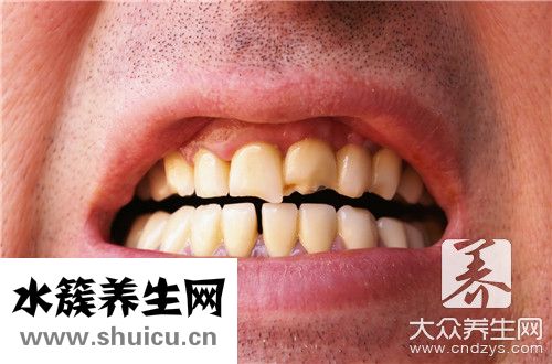 牙周炎牙齒松動辦