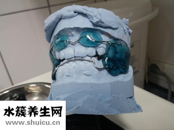 牙齒矯正器有用嗎