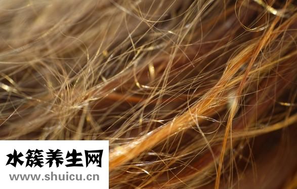 頭皮屑多又癢怎么辦