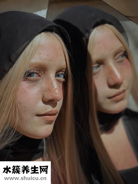 神經(jīng)性面癱