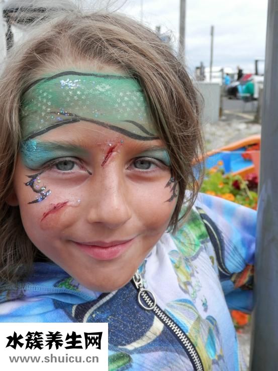 色素疤痕怎樣去除