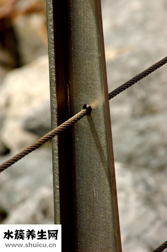 血管支架手術費用