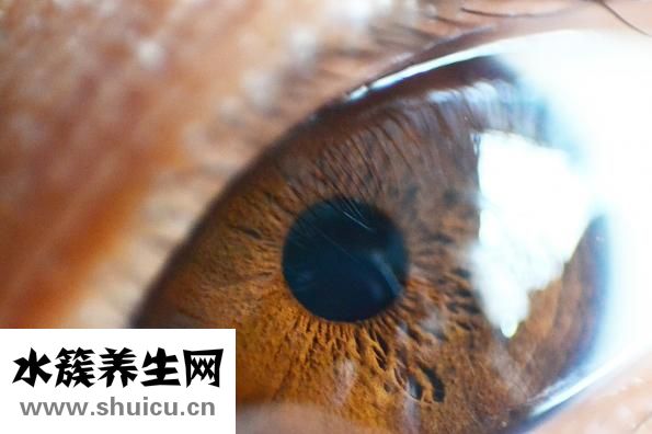 新生兒黃疸怎么辦