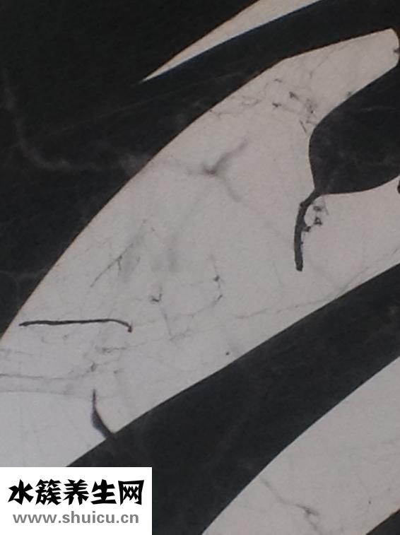 灰塵螨蟲過敏怎么辦