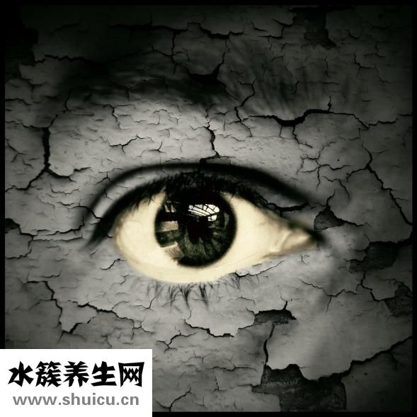 寶寶斗雞眼怎么矯正