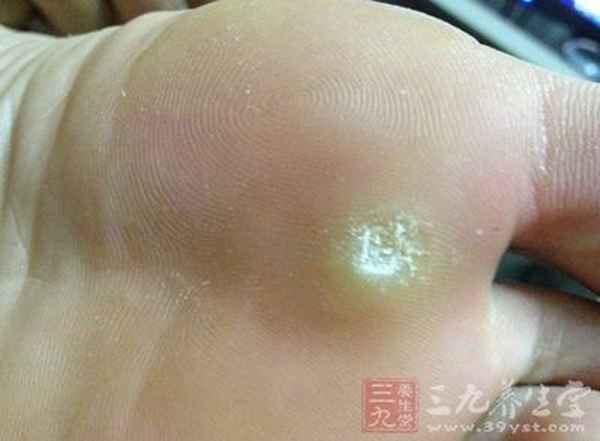 一吃就硬的25種偏方,夫妻之間多久同房一次才算正常