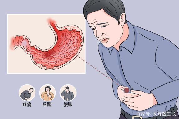 胃潰瘍的癥狀及表現，胃潰瘍有什么癥狀