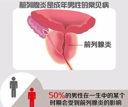 前列腺炎癥狀表現有哪些癥狀吃什么藥（前列腺炎癥狀表現有哪些癥狀）