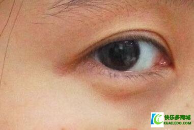 外傷角膜炎一般多長時間好（角膜炎一般多長時間好）