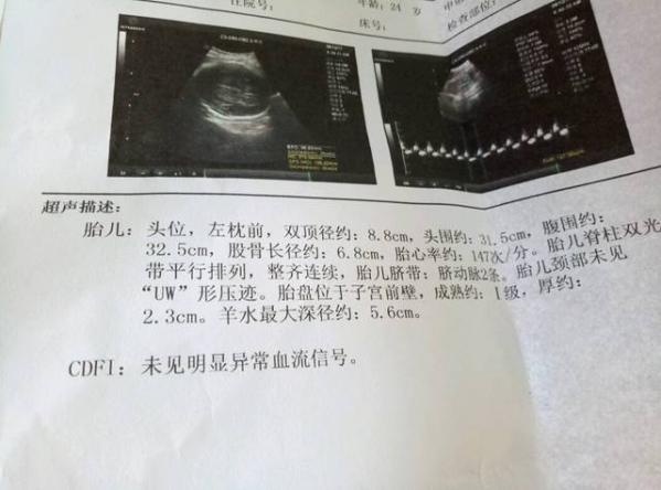 打一個(gè)月的胎兒要多少錢呢（打一個(gè)月的胎兒要多少錢）