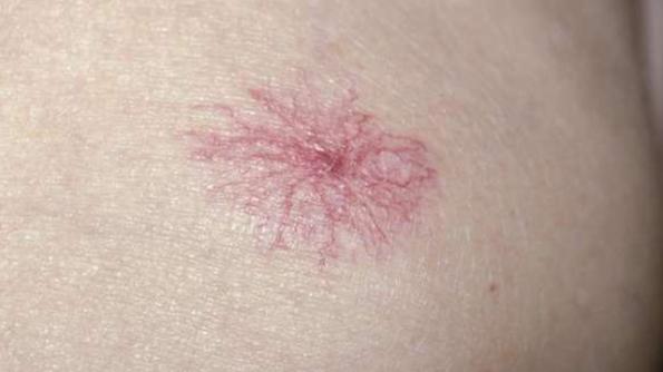 硬不起吃什么藥效果最好（硬起無力軟的快怎么治療）