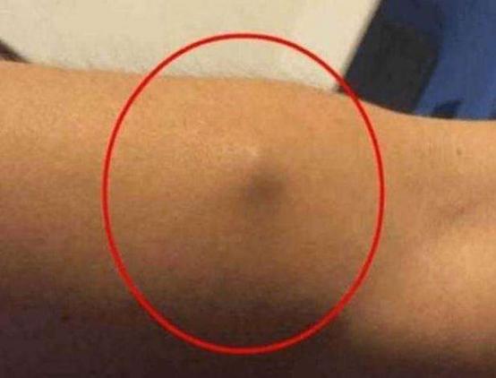 身體里長個(gè)小疙瘩摸著硬硬的（摸著硬硬的）