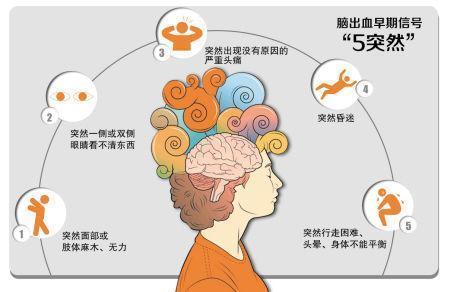 腦梗腦溢血的前兆是什么現(xiàn)象（腦溢血的前兆是什么現(xiàn)象）