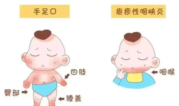 兒童腦炎的10個征兆會高燒（兒童腦炎的10個征兆）