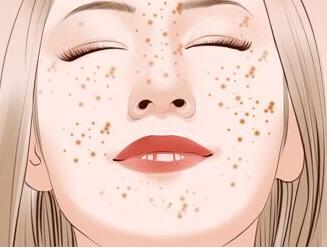 雀斑去除的最佳方法知乎（雀斑去除的最佳方法）