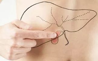 肝不好的人有哪些癥狀（肝不好的表現有哪些癥狀）