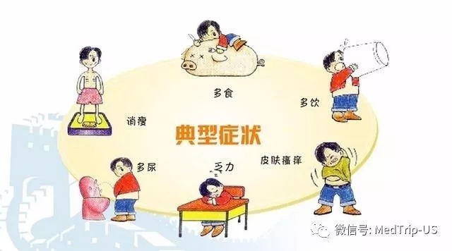 糖尿病前期的癥狀有哪些表現（糖尿病癥狀有哪些癥狀）