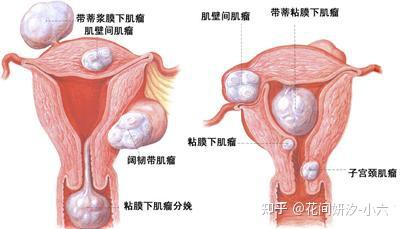 兒童支原體衣原體感染的癥狀有哪些（支原體衣原體感染的癥狀有哪些）