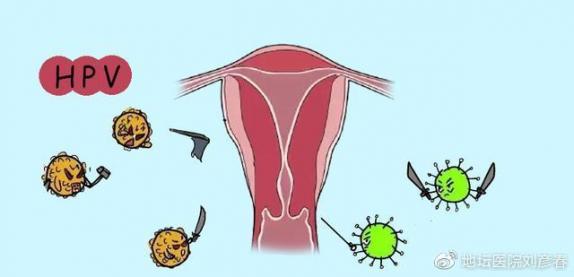 早期宮頸病變的明顯癥狀有哪些（早期宮頸病變有什么癥狀）