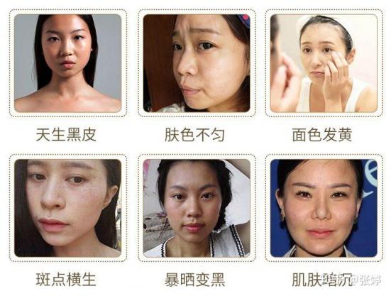 天生黑的人如何美白（天生黑的人如何美白學生）