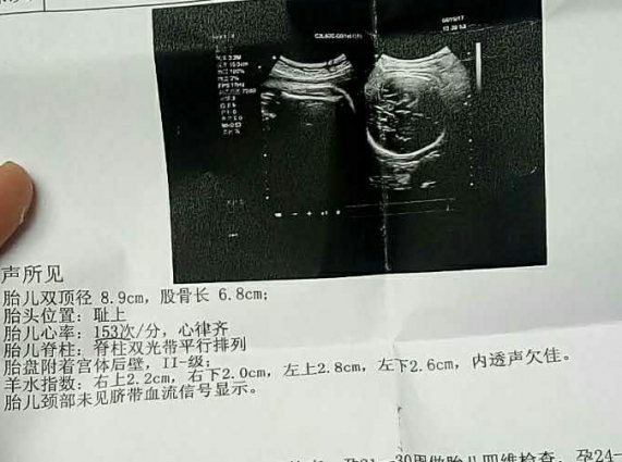 輸卵管造影多少錢大概多少錢（輸卵管造影多少錢大概多少錢二甲）