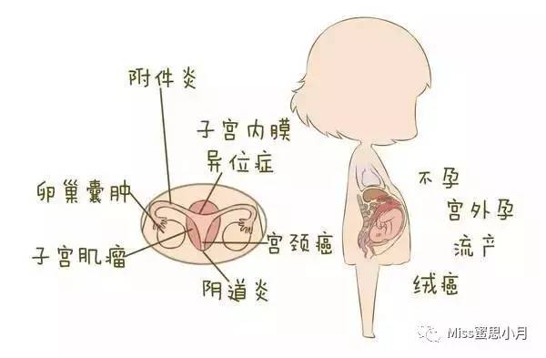 婦科霉菌是怎么引起的（女性霉菌是什么引起的）