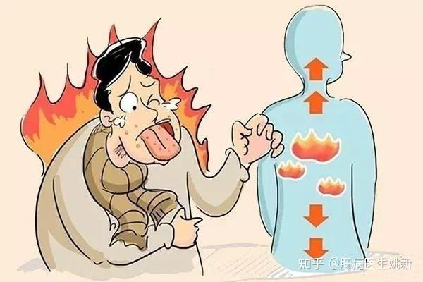 肝火旺的癥狀有哪些表現(xiàn)（肝火旺的癥狀有哪些表現(xiàn)男性）