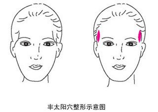 打玻尿酸的好處和壞處（打玻尿酸好處與危害）