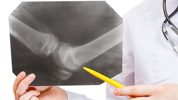 骨癌一般能活多久（骨癌一般能活多久腑癌轉(zhuǎn)移腦又腰椎手術(shù)后能活多久）