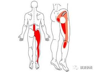 坐骨神經(jīng)痛的癥狀和治療方法(腰部坐骨神經(jīng)痛的癥狀和治療方法)