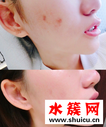 換季時(shí)刻:你有一份安瓶怎么使用方法待查收 換季時(shí)刻:你有一份安瓶怎么使用方法待查收